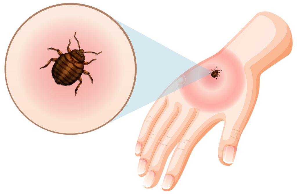 Lyme Disease Event March 25th