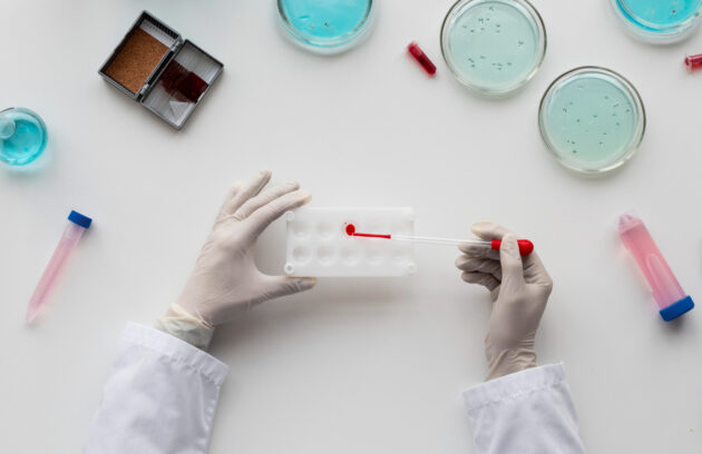 Hormone Tests